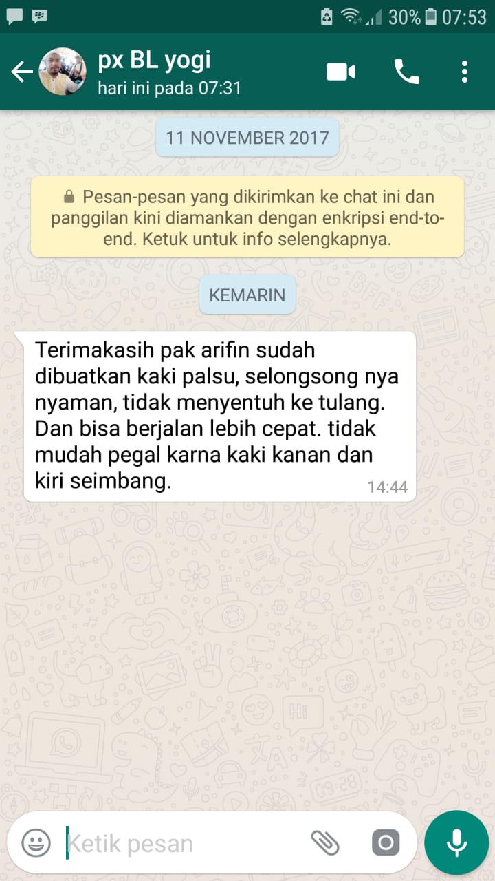 kaki palsu tidak mudah pegal jalan nama