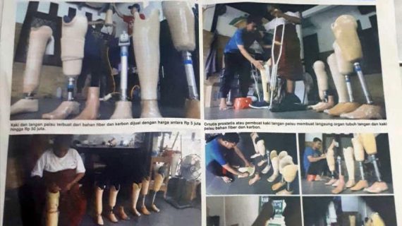 Harga Kaki Palsu Cilacap