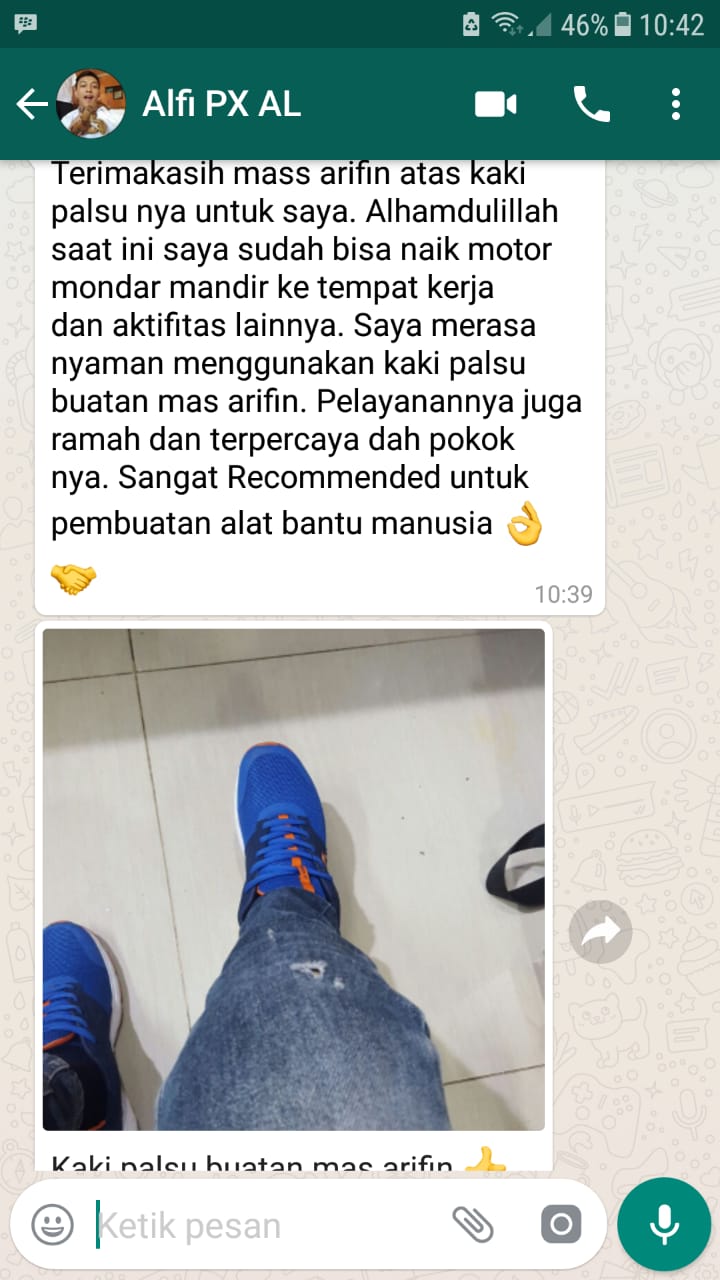kaki palsu tidak mudah pegal jalan nama