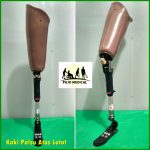 Harga Kaki Palsu Purwokerto