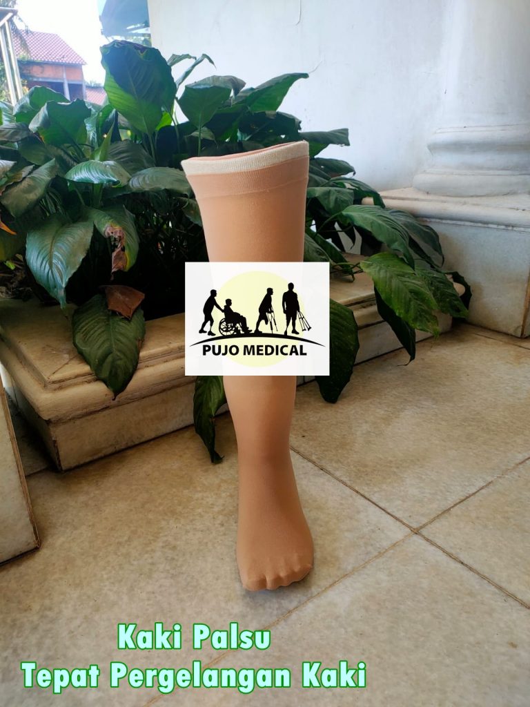 Jasa pembuatan kaki palsu Banten PUJO MEDICAL