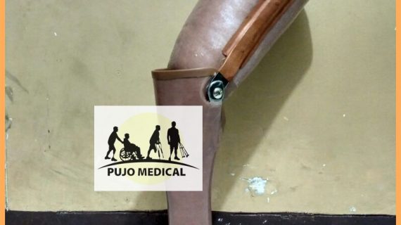 Pembuat Kaki Palsu Di Cilacap