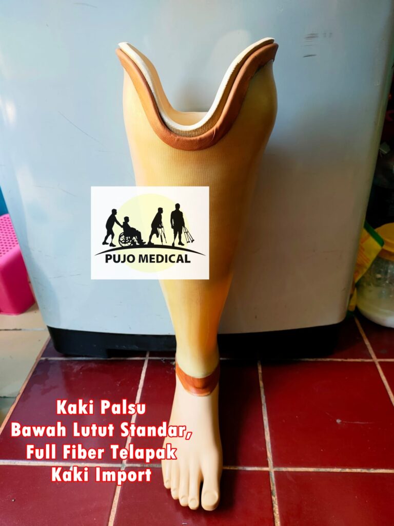 JJasa pembuatan kaki palsu Serang PUJO MEDICAL