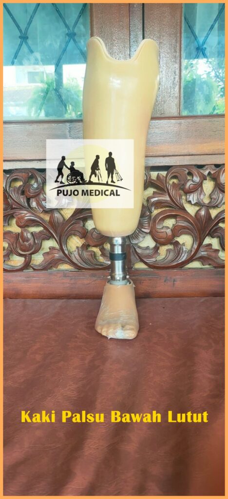 Jasa Pembautan Kaki Palsu Karawang