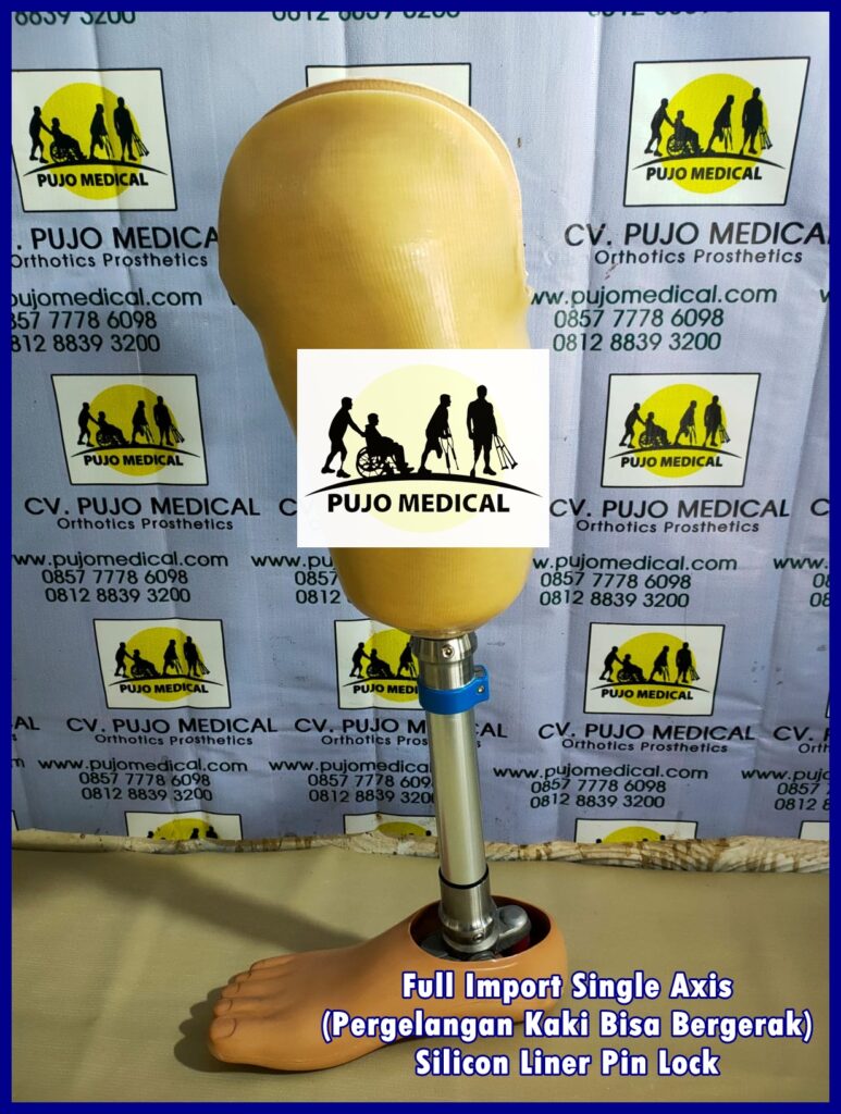 Jasa pembuatan kaki palsu Cilegon PUJO MEDICAL